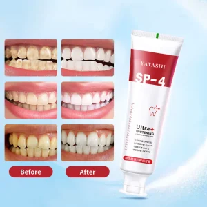 Yayashi SP4 Probiotic Whitening Toothpaste 120g – Removes Coffee, Tea & Smoking Stains